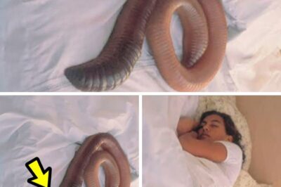 The ‘Pregnancy’ That Baffled Doctors: What Was Really Growing Inside This 50-Year-Old Woman?